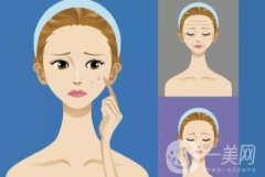 人造酒窩是否看起來自然