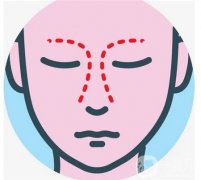 如何避免鼻頭縮小手術(shù)后的增生呢？