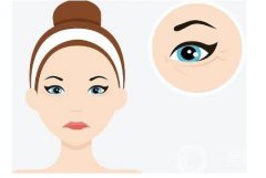 如何處理埋線雙眼皮術(shù)后感染