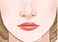 如何有效避免鼻整形修復帶來的二次傷害？