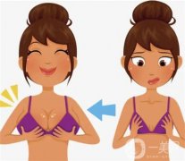 乳暈縮小手術(shù)的效果如何呢？