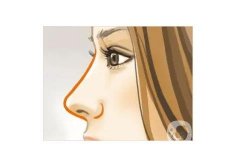 鼻基底填充后可能會(huì)有哪些后遺癥