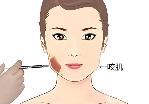 喬雅登雅致和極致區(qū)別在哪?信息對比一覽